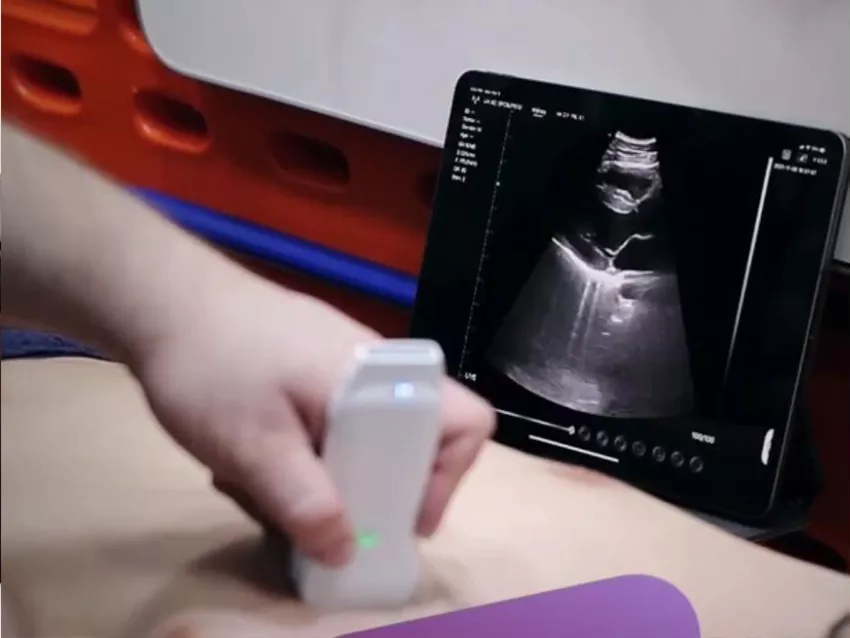 Konted C10TX Ultrasound: Redefining the Future of Diagnostic Imaging