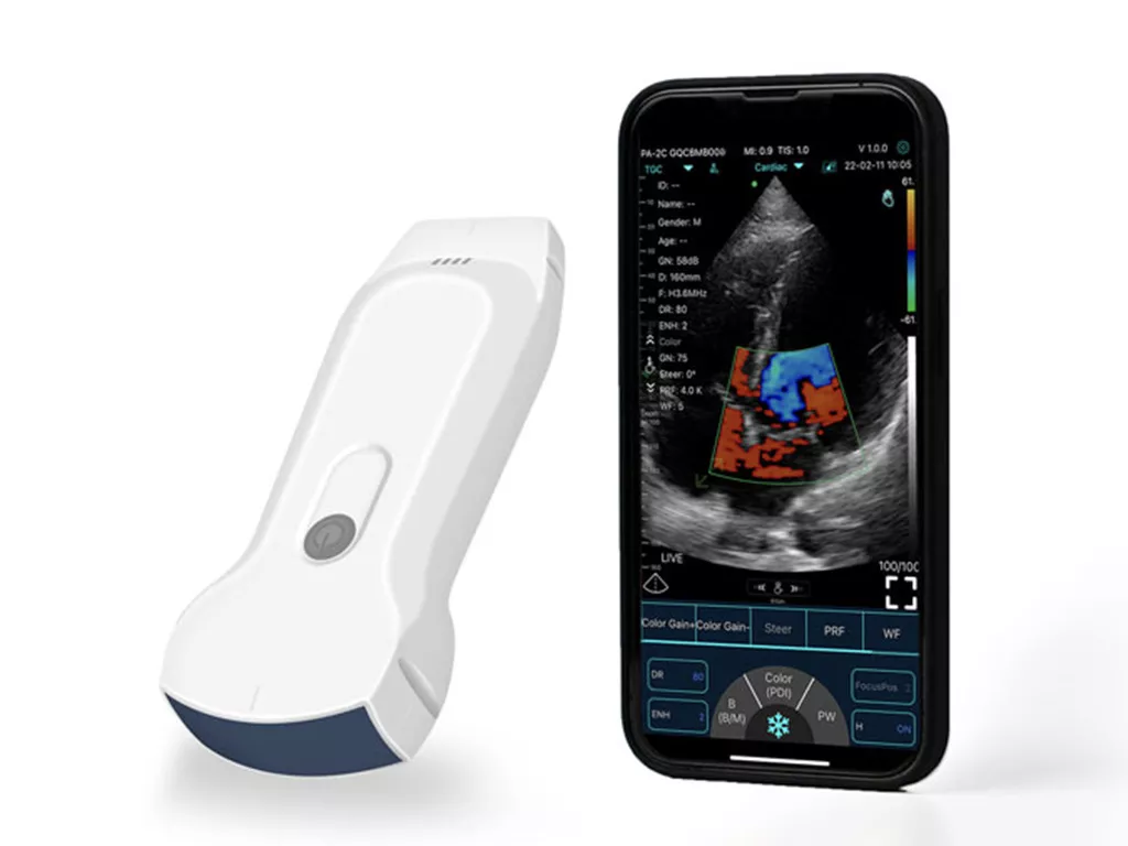KONTED C10TX: 3-in-1 Wireless Handheld Ultrasound (Convex, Linear, Cardiac)