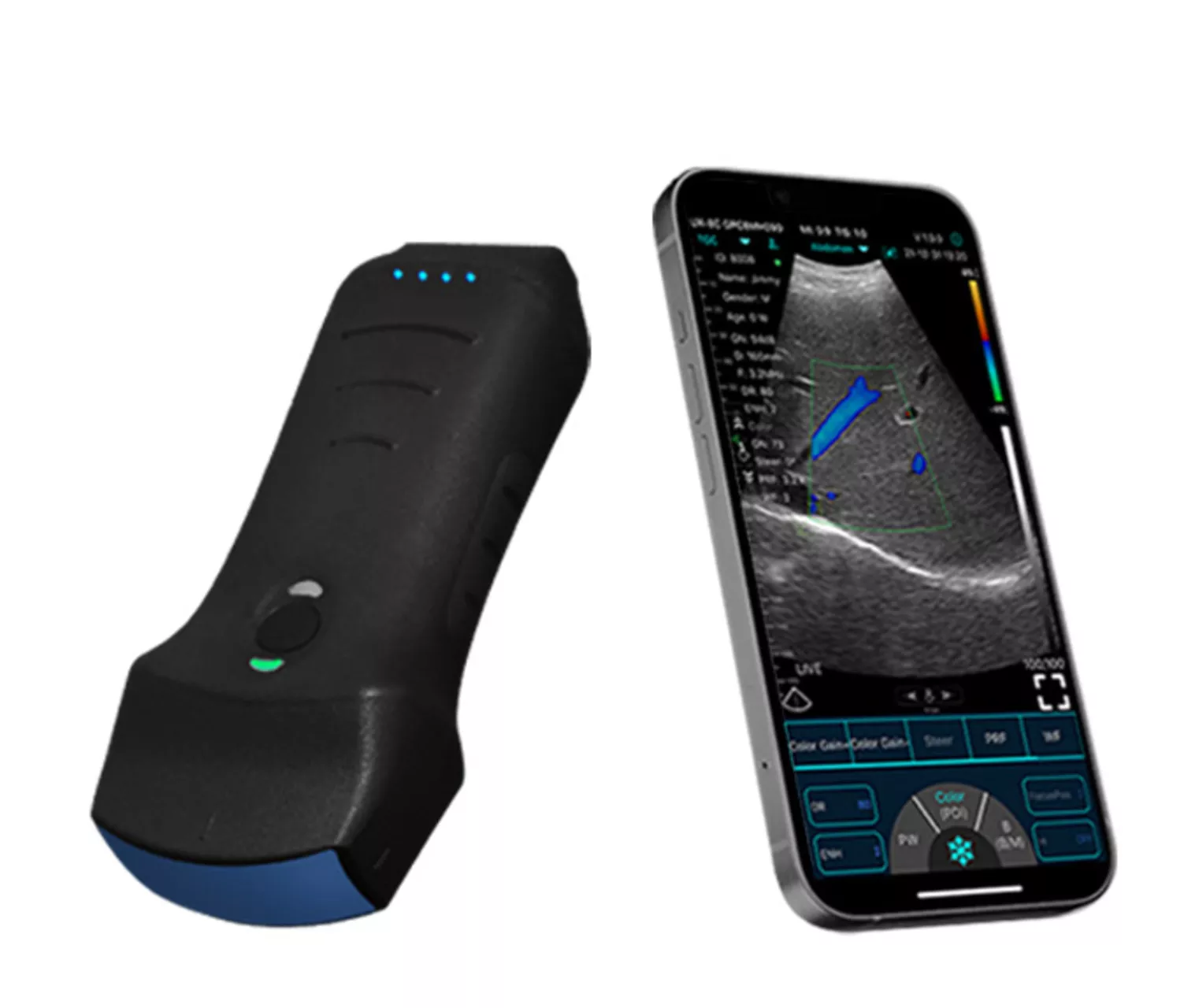 KONTED C10TX: 3-in-1 Wireless Handheld Ultrasound (Convex, Linear, Cardiac)