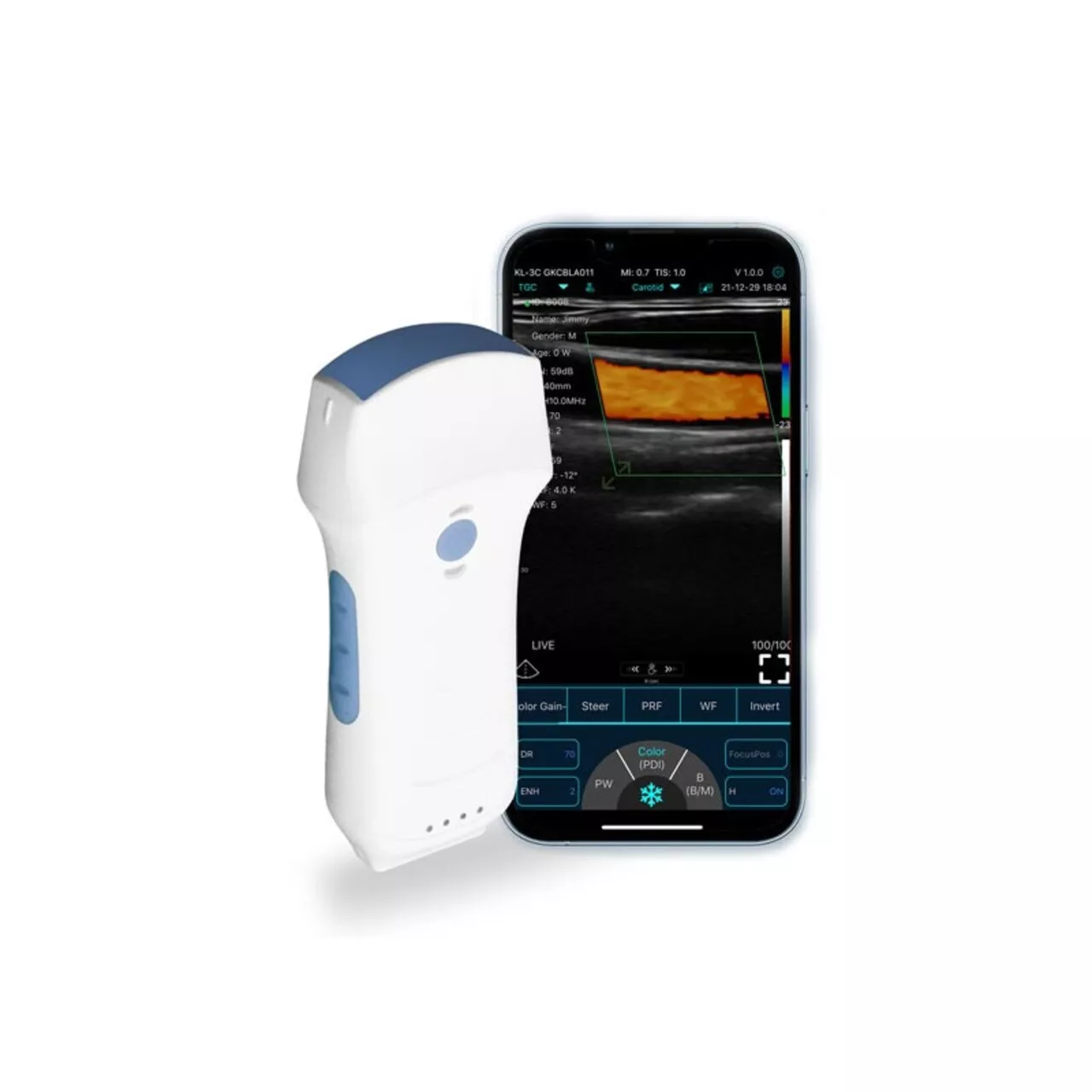 KONTED C10TX: 3-in-1 Wireless Handheld Ultrasound (Convex, Linear, Cardiac)