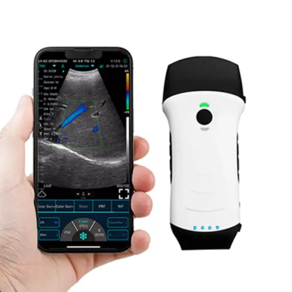 Konted_C10TX_Ultrasound