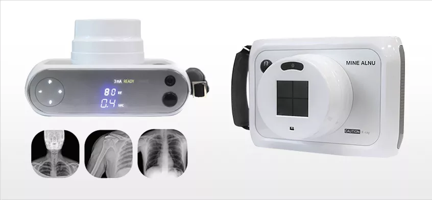 MINE ALNU (Nooka): Φορητό Σύστημα Ακτινογραφίας με AI & FDA