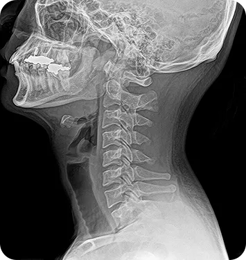 MINE ALNU (Nooka): Φορητό Σύστημα Ακτινογραφίας με AI & FDA