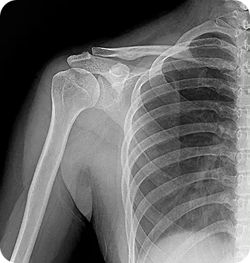 MINE ALNU (Nooka): FDA-Approved 2.7kg Handheld X-Ray with AI Enhancement