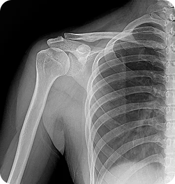 MINE ALNU (Nooka): Φορητό Σύστημα Ακτινογραφίας με AI & FDA