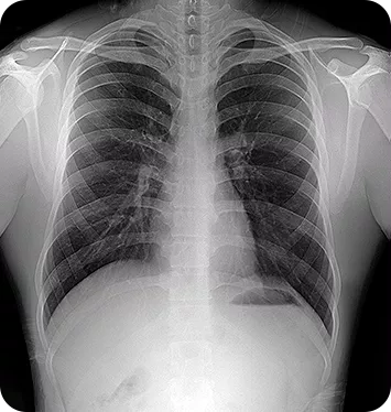 MINE ALNU (Nooka): Φορητό Σύστημα Ακτινογραφίας με AI & FDA