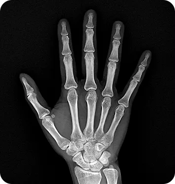 MINE ALNU (Nooka): Φορητό Σύστημα Ακτινογραφίας με AI & FDA