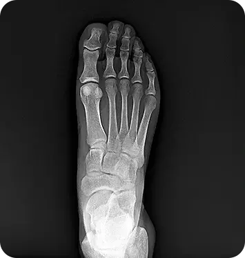 MINE ALNU (Nooka): FDA-Approved 2.7kg Handheld X-Ray with AI Enhancement