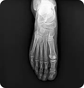 MINE ALNU (Nooka): FDA-Approved 2.7kg Handheld X-Ray with AI Enhancement