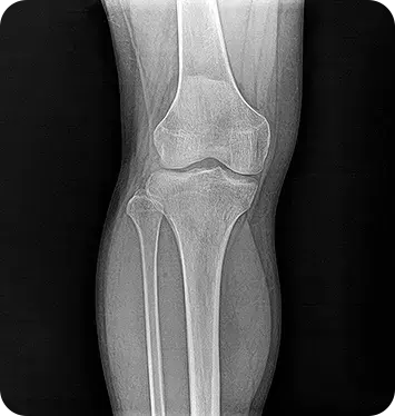 MINE ALNU (Nooka): FDA-Approved 2.7kg Handheld X-Ray with AI Enhancement