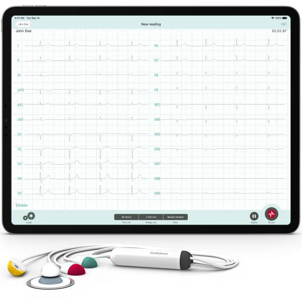 Συσκευή ΗΚΓ Cardiosecur Pro και οθόνη iPad Cardiosecur Pro ECG device and iPad screen