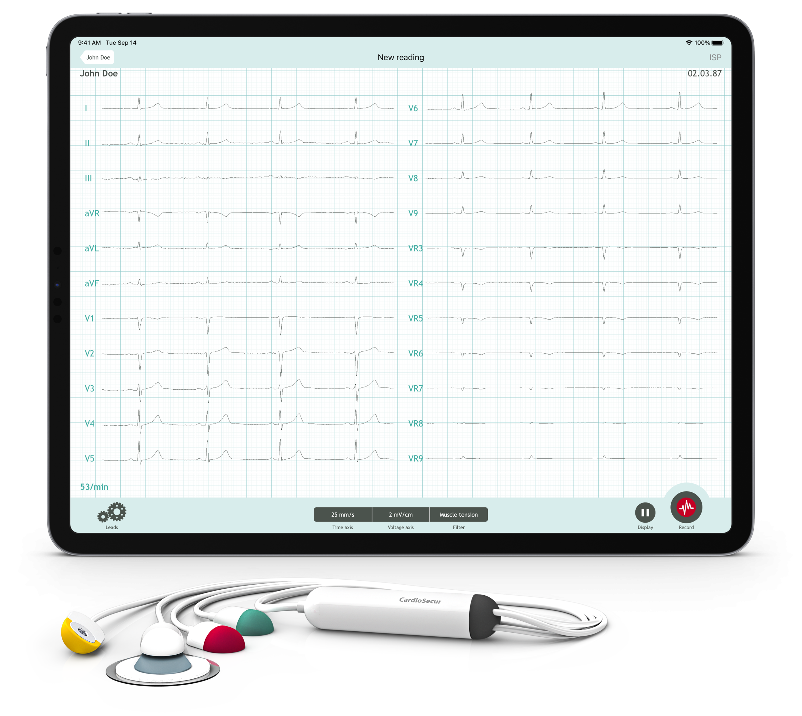 CardioSecur Pro: Professional 22-Lead Wireless ECG for Smartphones