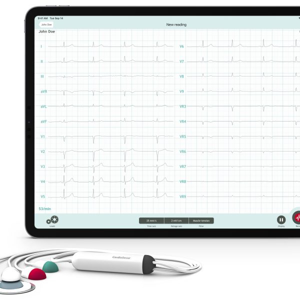 Cardiosecur_Pro_ECG_with_ipad