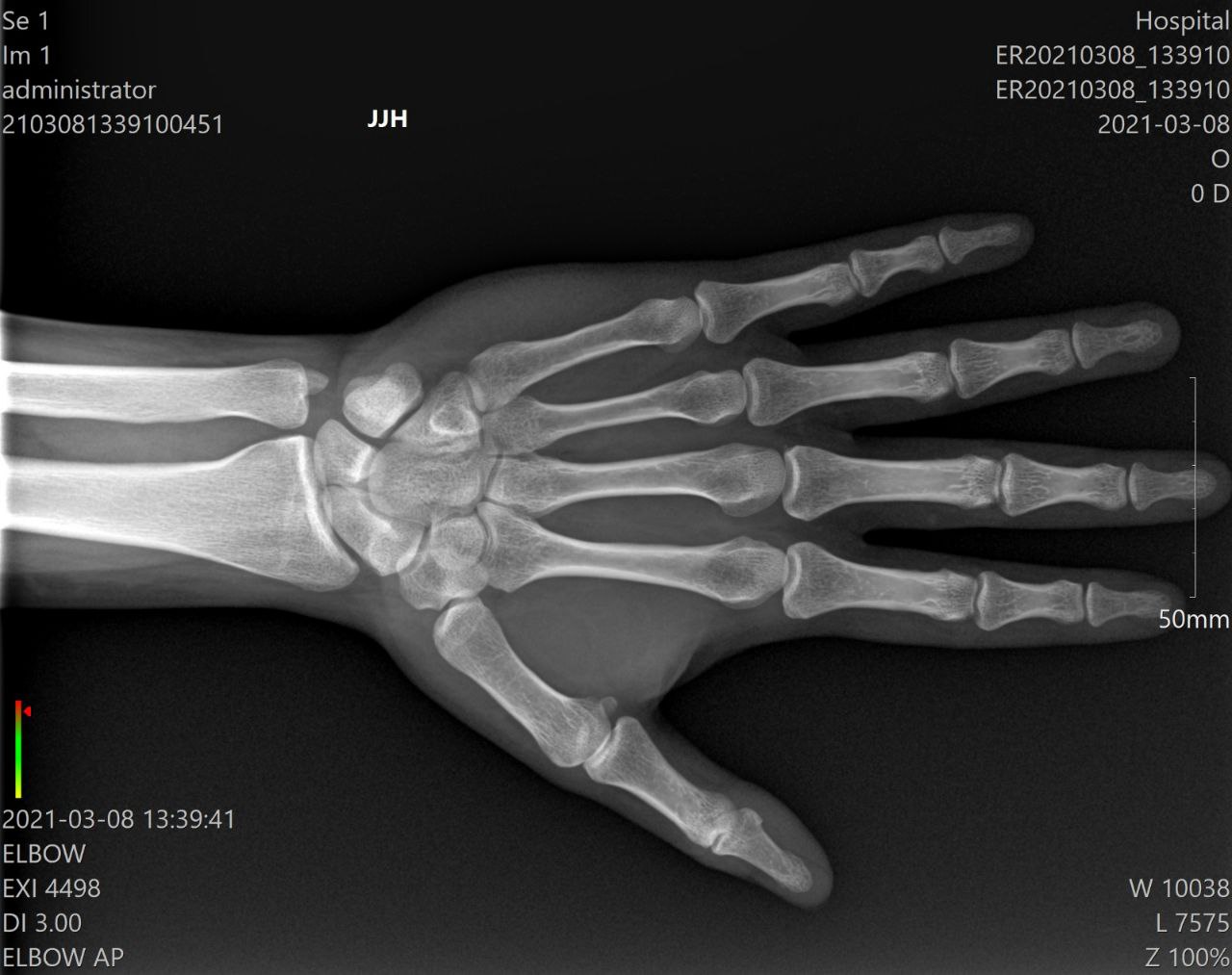 OTOM MX30 X-ray