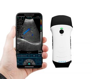 Konted C10TX Ultrasound and an iPhone: Redefining the Future of Diagnostic Imaging