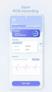 Wellysis S-Patch ExL: AI-Powered Wearable ECG Patch & Wireless Holter