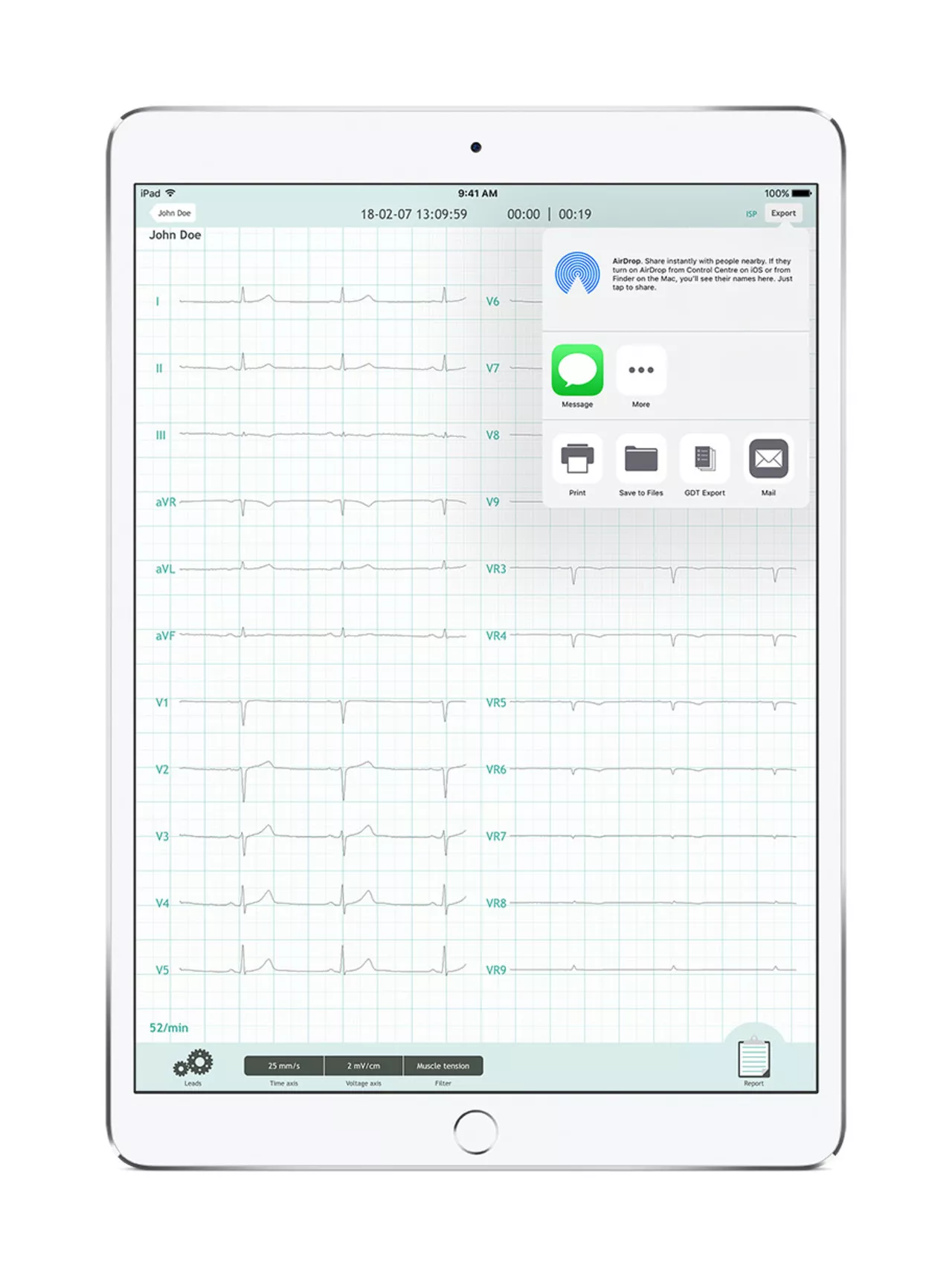 CardioSecur Pro: Professional 22-Lead Wireless ECG for Smartphones
