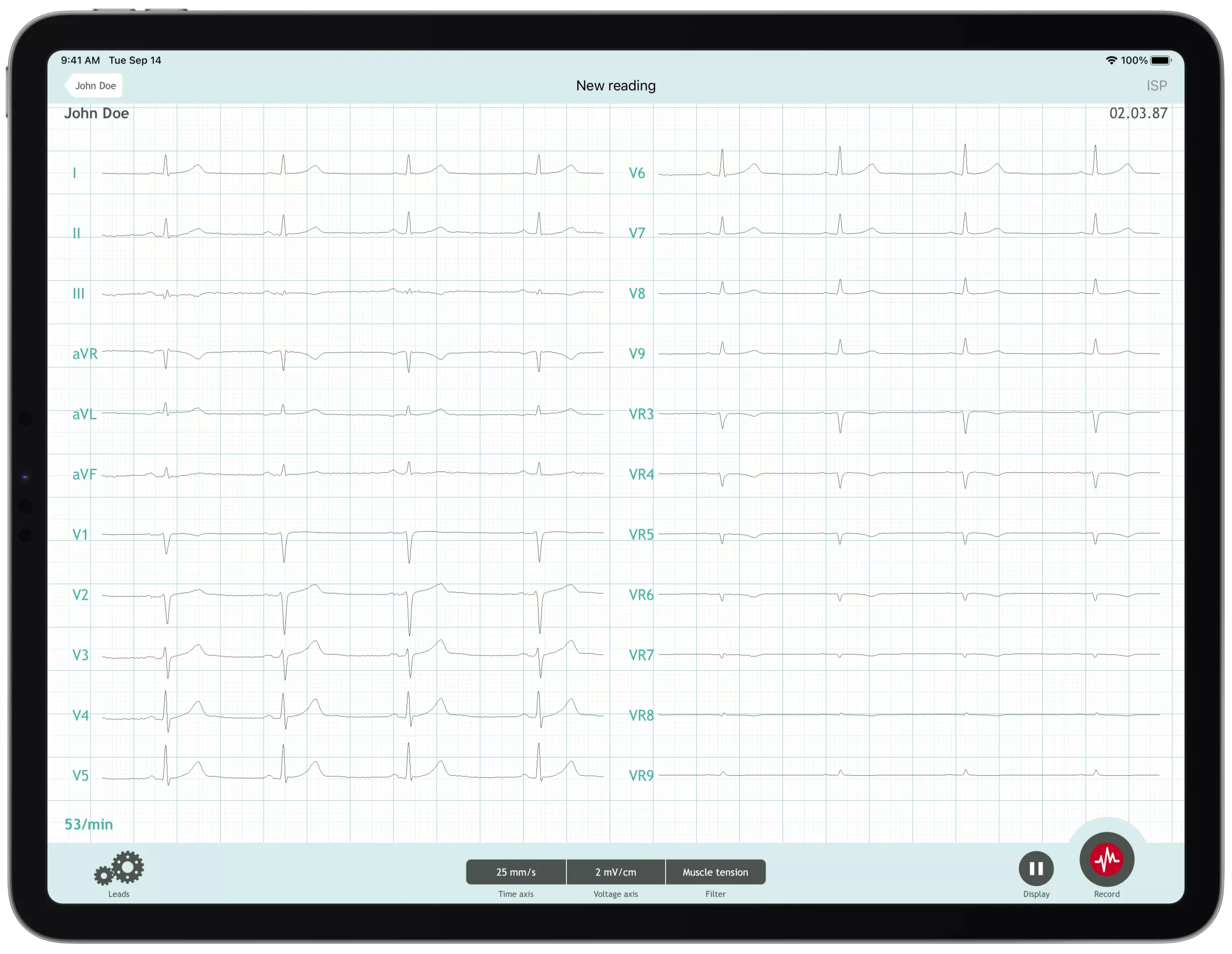 CardioSecur Pro: Professional 22-Lead Wireless ECG for Smartphones