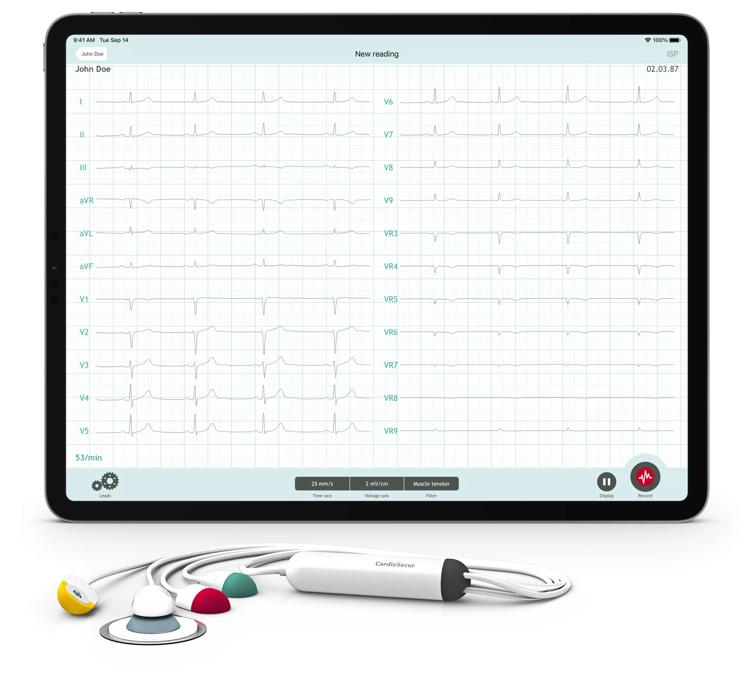 CardioSecur Pro: Professional 22-Lead Wireless ECG for Smartphones