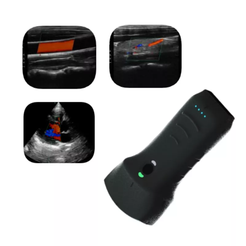 KONTED C10TXpro 3-in-1 Handheld Wireless Ultrasound (192 Elements | 64-Channel)