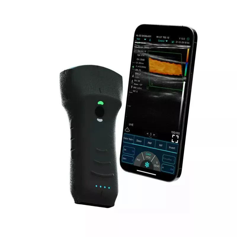 KONTED C10TXpro 3-in-1 Handheld Wireless Ultrasound (192 Elements | 64-Channel)