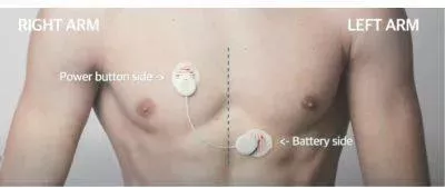 Wellysis S-Patch Ex – Advanced AI-Powered Cardiac ECG Solution